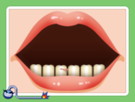 WWG Oral Hijinks.png